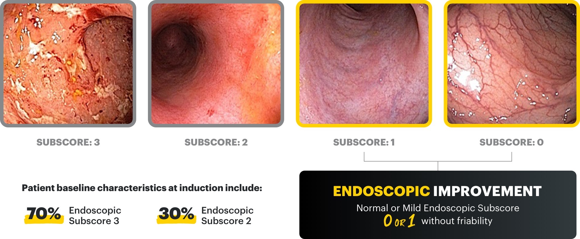 Subscore: 3, Subscore: 2, Subscore: 1, and Subscore: 0. Endoscopic improvement (normal to mild endoscopic subscore 0 or 1 without friability). Patient baseline characteristics at induction include: 70% endoscopic subscore 3 and 30% endoscopic subscore 2.